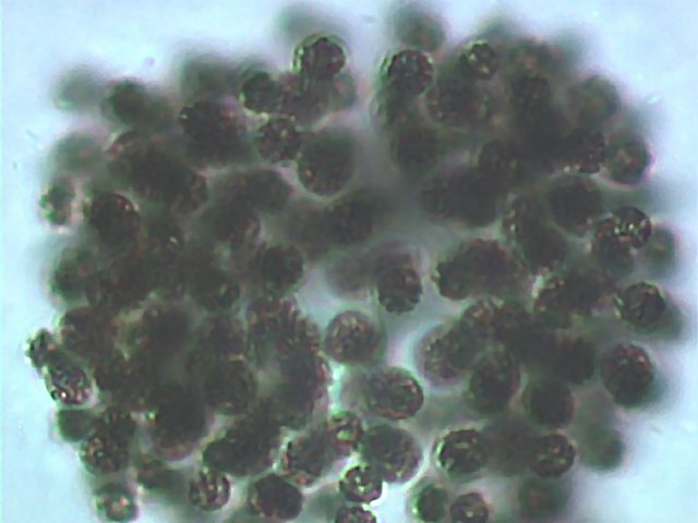 Microcistes