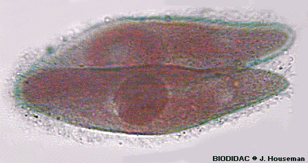 Conxugación entre dous paramecios Conxugación entre dous paramecios
