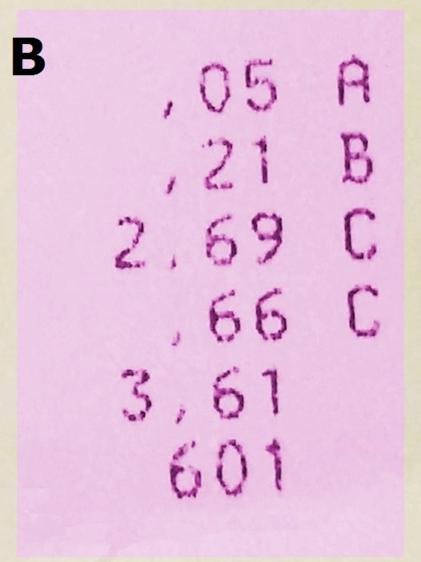 Imagen de un recorte del ticket de la compra con el importe de los artículos.