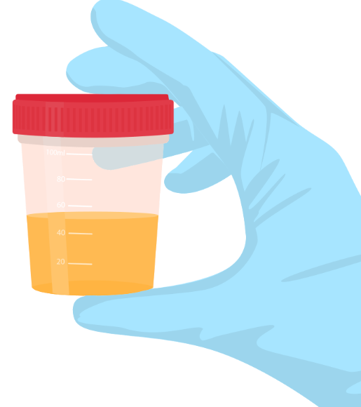 ilustracion analitica de urina