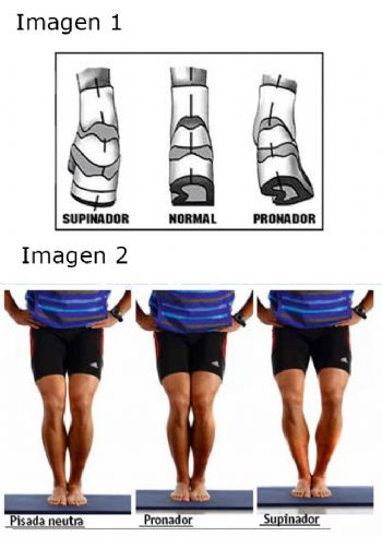 Diferentes tipos de pregada