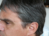 Imagen de un chico con el cabello oscuro y algunas canas dispersas, sobre todo por el contorno de la cabeza.