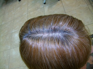  Imagen de una raíz con una cantidad de canas superior al color natural.  En medios y puntas el cabello está teñido de rubio.