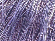 Se ve un cuero cabelludo con mucha densidad de cabello.