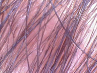 Se ve un cuero cabelludo con poca densidad de cabello.