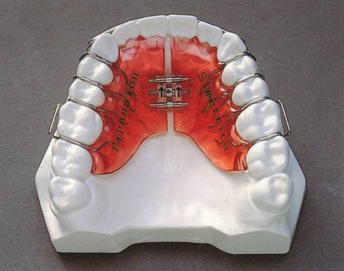 Placa de expansión