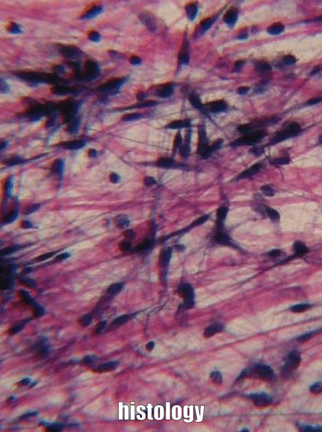 Tejido conjuntivo fibroso