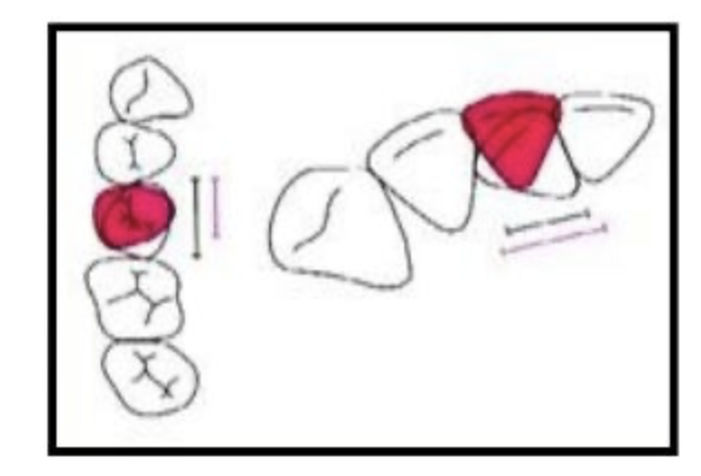 Rotación axial