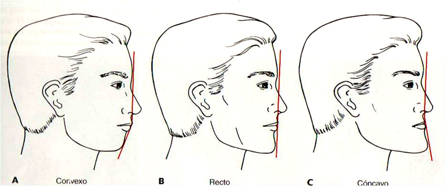 Perfiles faciales