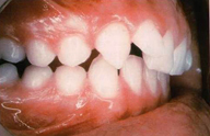 Clase II división 2