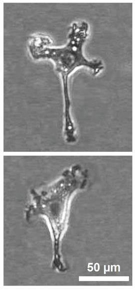 Astrocitos de Hortega